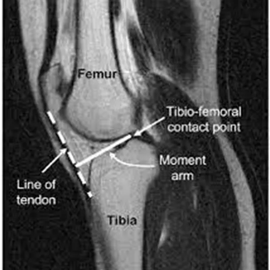 MRI Joint Screening of Left Knee